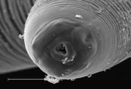 Fig. 2. Escaneado de microscopio electrónico de un nematodo Anisakis. Fuente: Wikkimedia Commons.