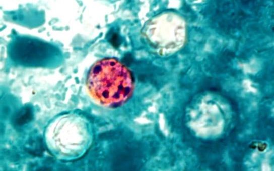 Fig. 1. Imagen de microscopio de oquistes del parásito Cyclospora cayetanensis. Imagen: Center for Disease Control and Prevention (CDC). Fuente: Wikkimedia Commons.